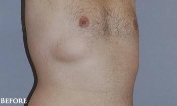 1576667578_before.jpg